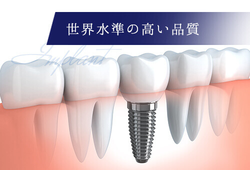 世界水準の高い品質